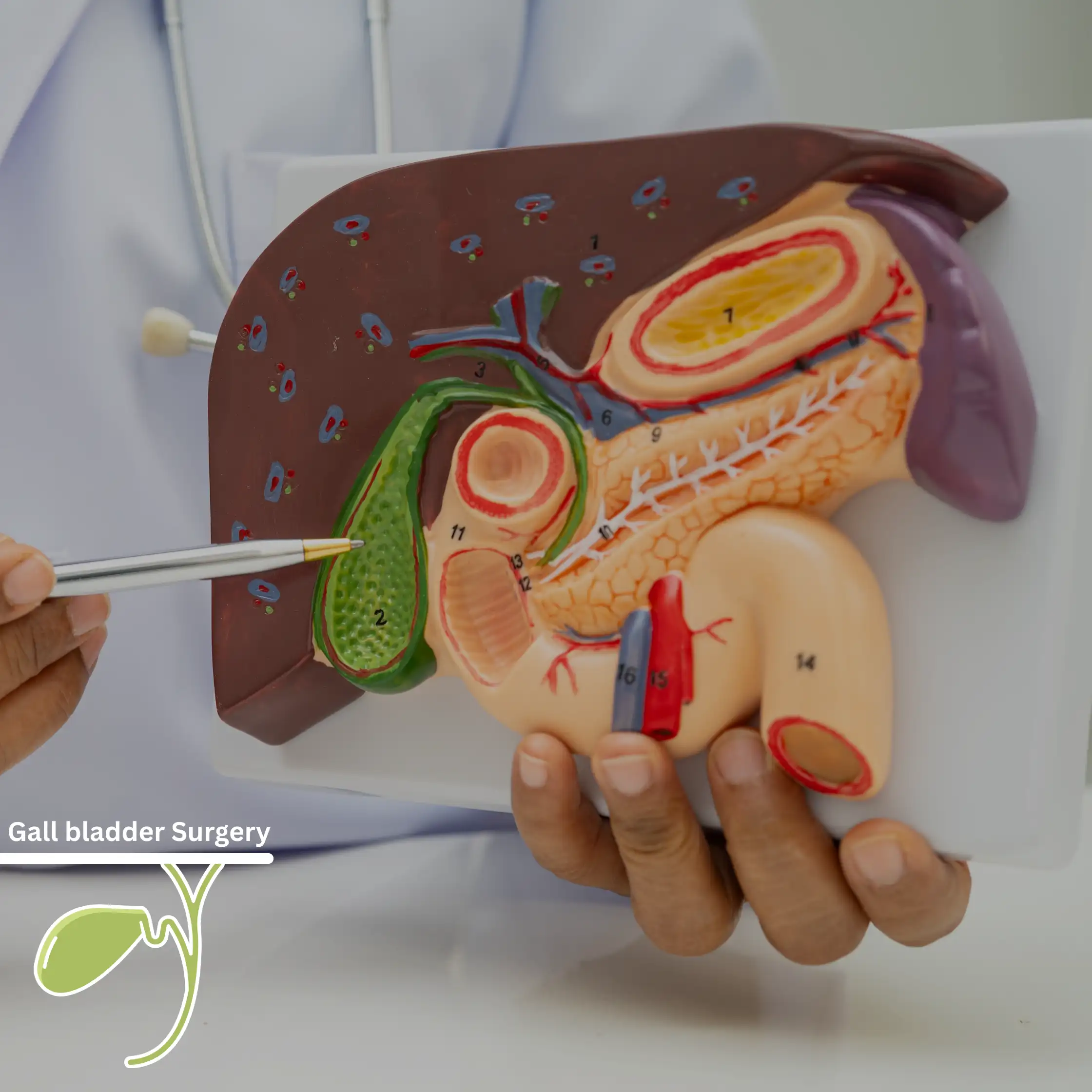 When and Why Gallbladder Removal is Necessary for Gallstones: A Complete Guide