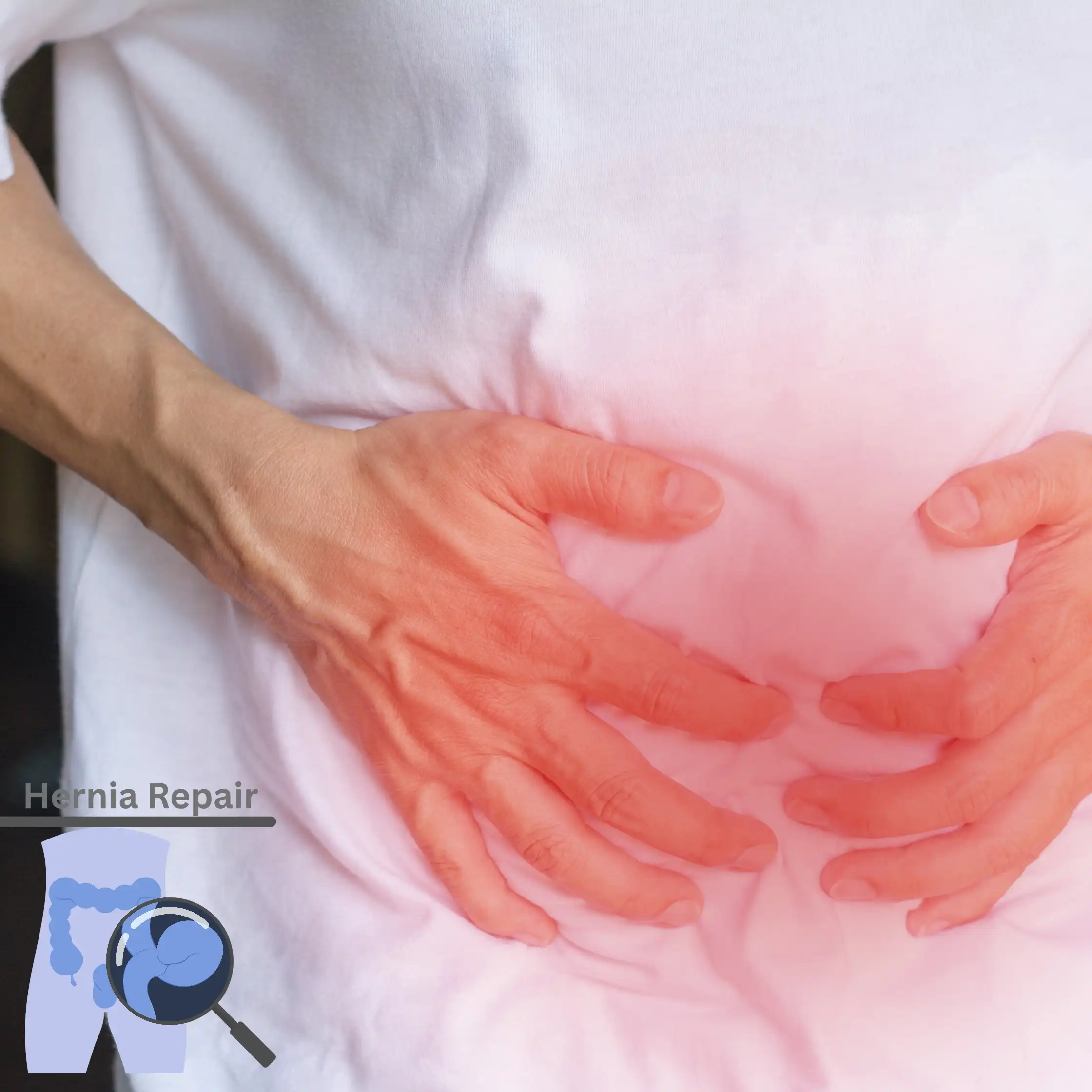 Comprehensive Guide to Hernia Treatment